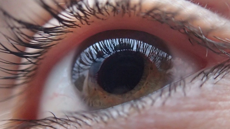 Emergenza Glaucoma: come possiamo prevenire i danni? 8 Glaucoma