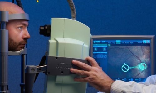 Fluoroangiografia